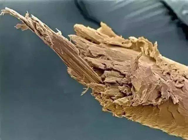 显微镜下放大的头皮与头发