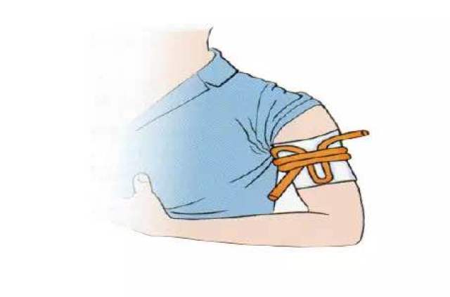 用干净的纱布,棉垫等敷料覆盖住伤口,再用绷带加压包扎起来.  2.