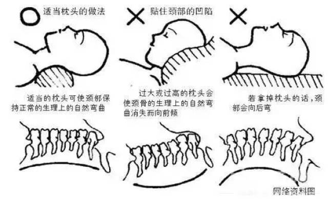 富贵枕骨相,枕骨隆突的运,大贵骨相(第8页)_大山谷图库