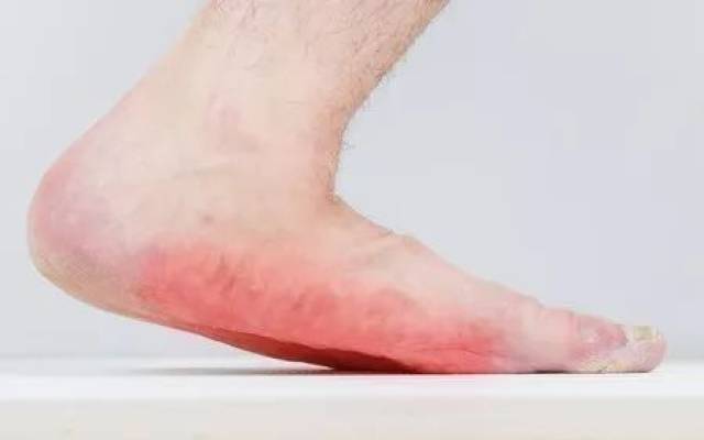 作为走不了远路就会累会痛的 "平jio板" 真是太遭罪了 爬山赏秋,跑步