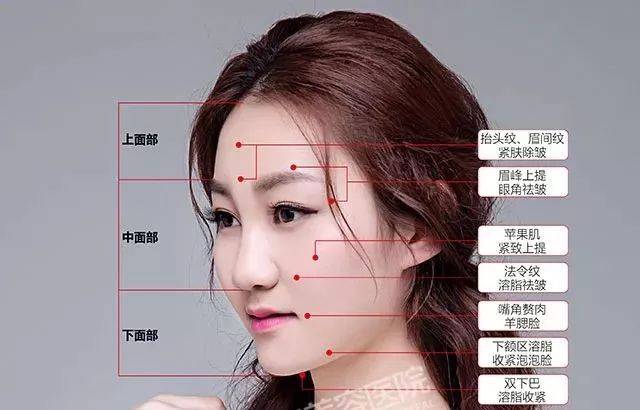 松垂组织的提拉等综合性的手术步骤,来共同防止脸部进一步下垂