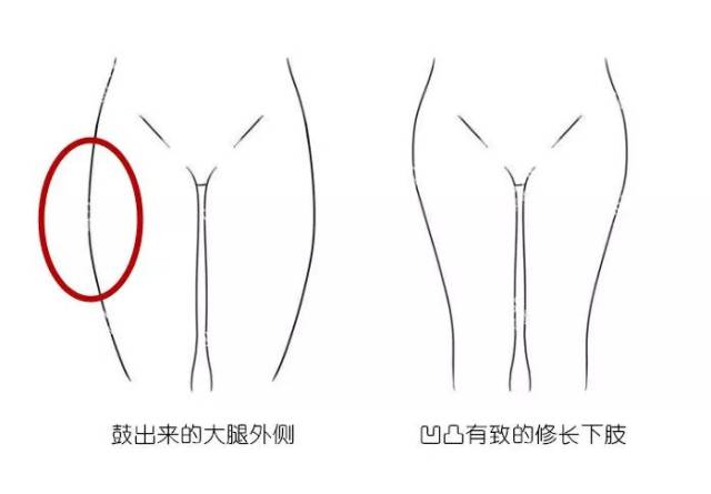 健身常識 |大腿顯粗?很可能是骨頭的原因哦!