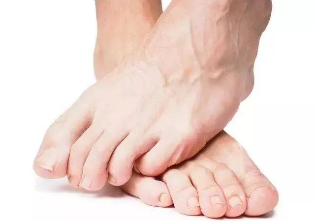 人体自带排尿酸高手掌握好用法痛风不痛