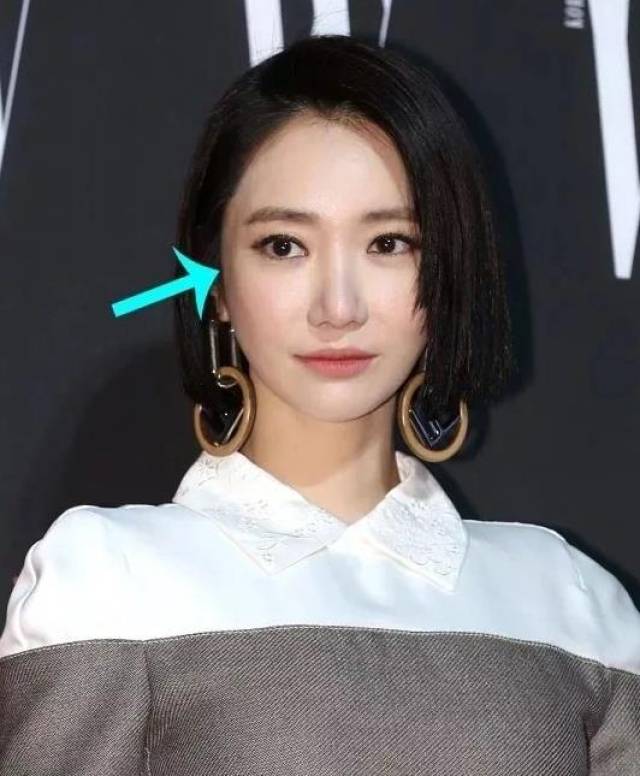 许久不见的高俊熙脸变发面馒头,鼻假体都要戳破屏幕了!