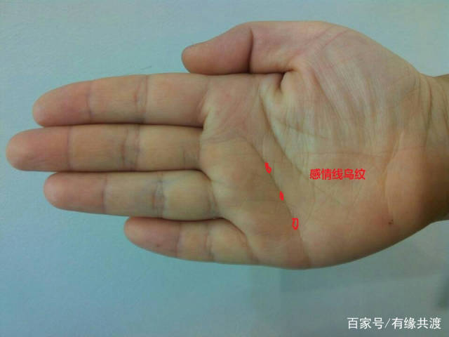 5, 感情线上有岛纹