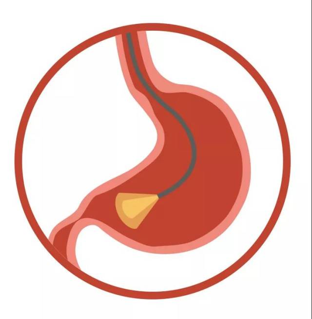 【答个疑】胃肠镜检查,如何做准备?