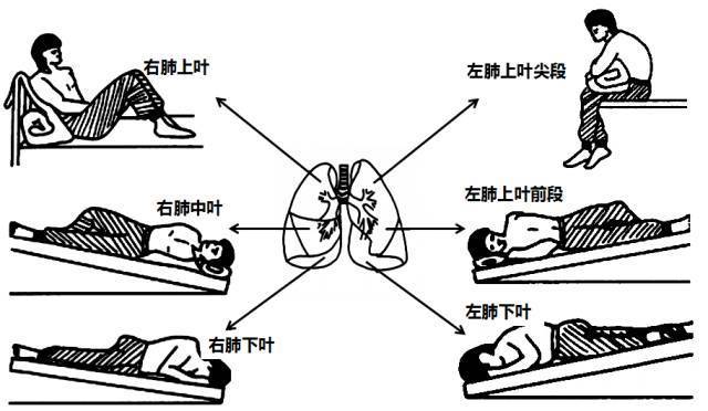 痰在什么位置,痰在气管的位置图,痰从哪里来_大山谷图库