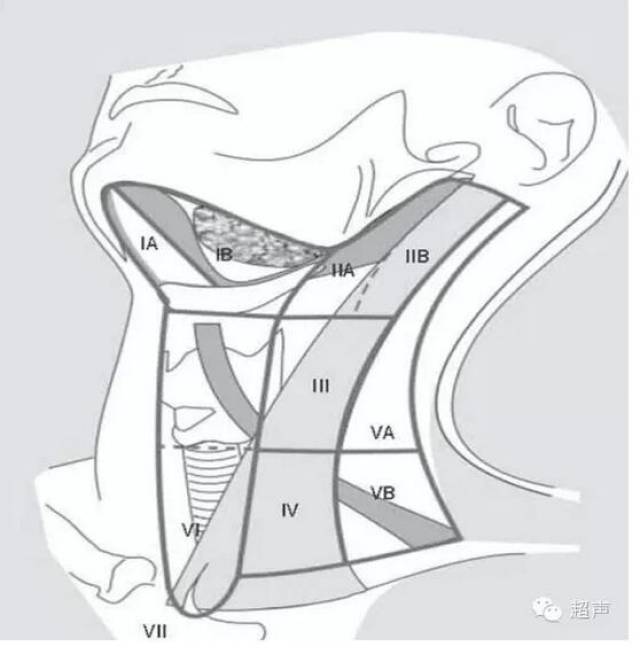 頸部淋巴結分區轉載