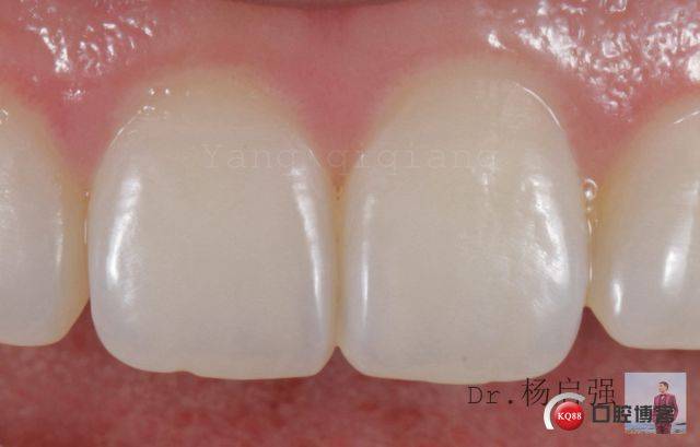 前牙天然形态图集