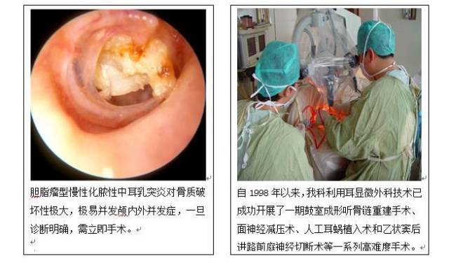 慢性化脓性中耳炎的耳显微手术治疗 手机搜狐网
