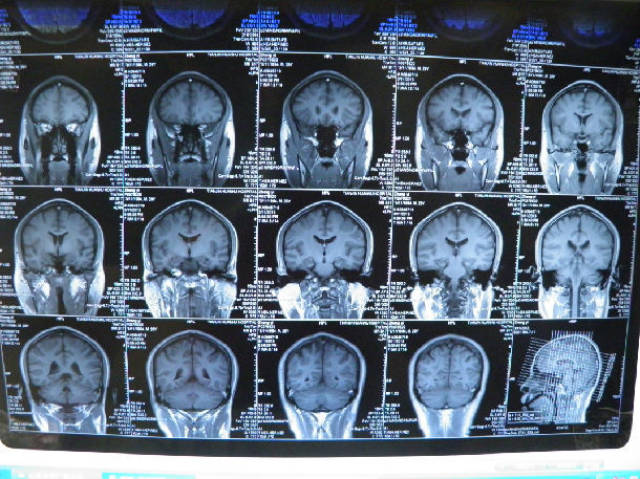 (3)矢状位 矢状位是从头颅左侧到右侧进行扫描,如图