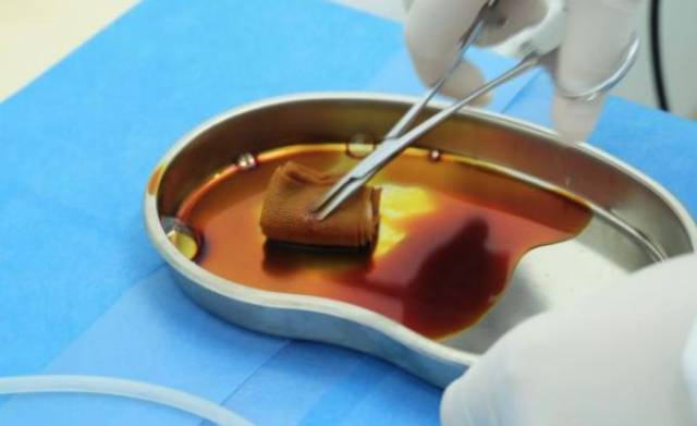 &医院 毕竟是打针不是敷面膜 卸妆洁面敷麻药 在脸表层敷表面麻醉剂