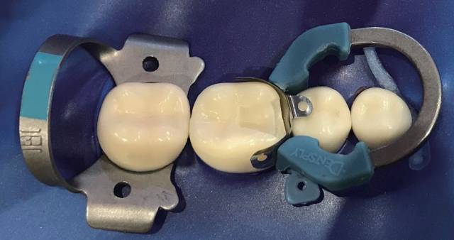 邻面成形片的使用