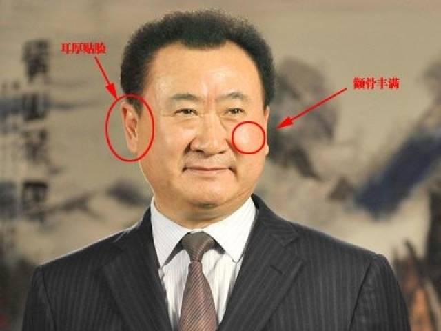 太阳穴凹陷怎么办换个发型就好了天庭饱满还显脸小