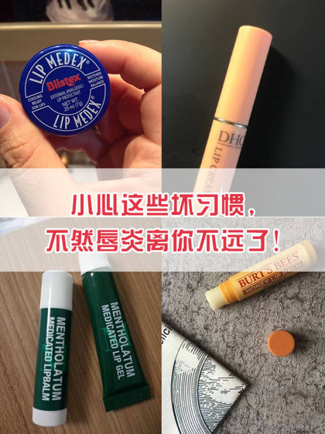 小心这些坏习惯,不然唇炎离你不远了!
