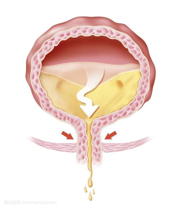 憋尿,最长可以憋多久?