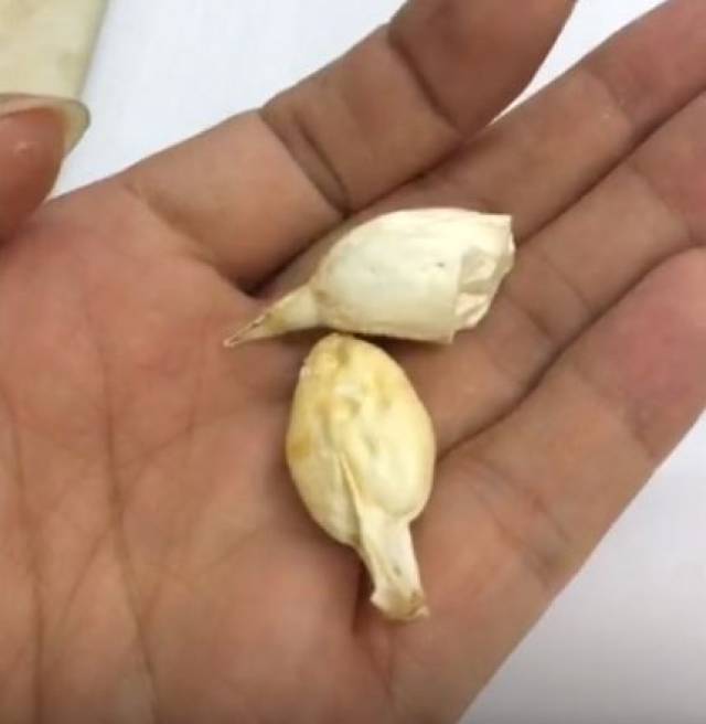 从鱼肉中分离出 两块 黄白色的"石头" 这两个长得跟蒜头差不多的东西