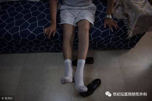 小儿麻痹后遗症会越来越严重吗?专家告诉你!