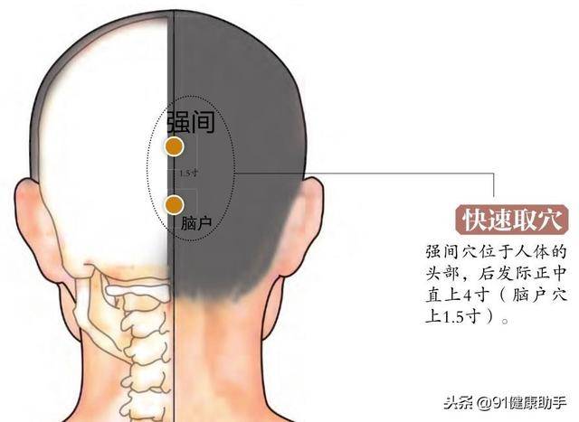 穴位养生|经常性失眠,工作压力大,不妨按按强间穴,放松身心