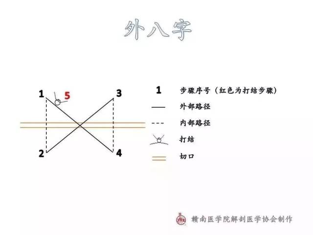 图解|常用外科缝合路径示意图