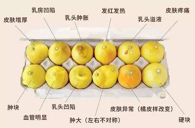 女性哺乳期怎样自查乳腺癌?