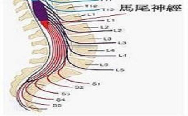 脊柱脊髓损伤治疗与康复专家李建军教授谈 马尾神经损伤的治疗