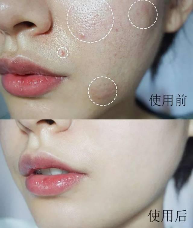 一款深层清洁毛孔垃圾的按摩膏,有效改善痘痘,黑头,粉刺,毛孔粗大问题
