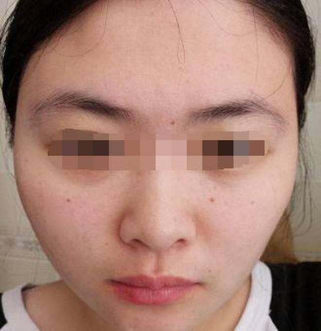 司空凹陷的女人面相图片