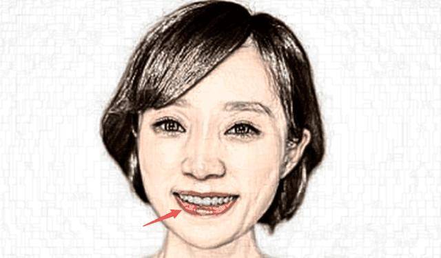 唇不包齿唇不包齿指的是一个人的嘴唇盖不住牙齿,牙齿前突,这种面相的