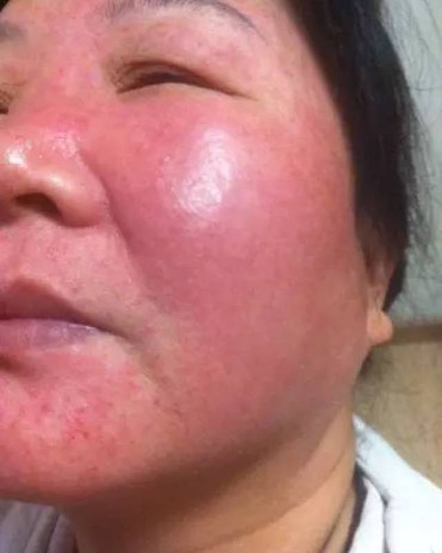 不要自己着急吓自己 找到原因才是解救而办法的根本 3  引起各种虫病