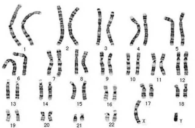 如何解读人类染色体核型分析报告