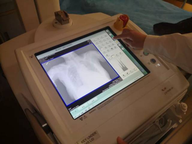 更方便啦!新钢中心医院引进全市首台移动dr式床旁摄片机