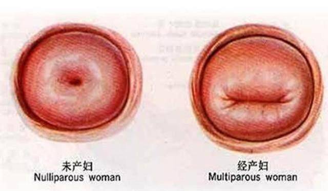 另外有过生育的女性,其阴道口不一样,相比较未生产过的女性很容易扩张