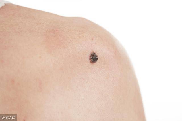 皮肤癌出现后人们的身体有什么感觉呢