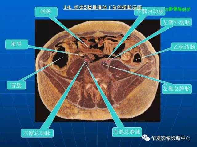 腹部断层影像解剖