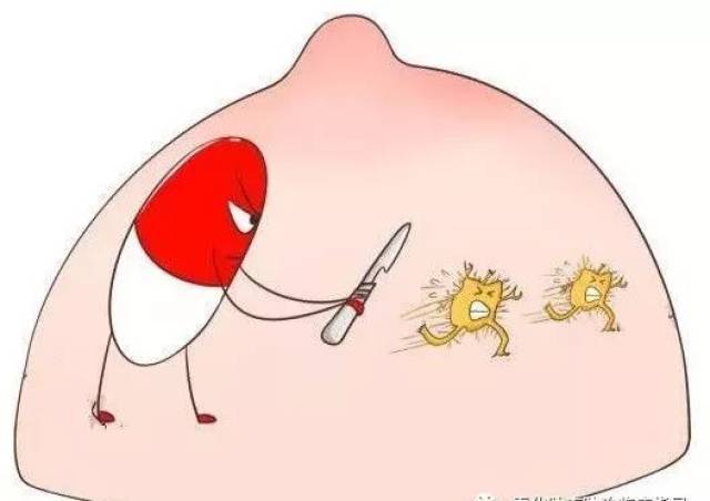 化疗后乳房肿块消失,医生竟然还要给她开刀