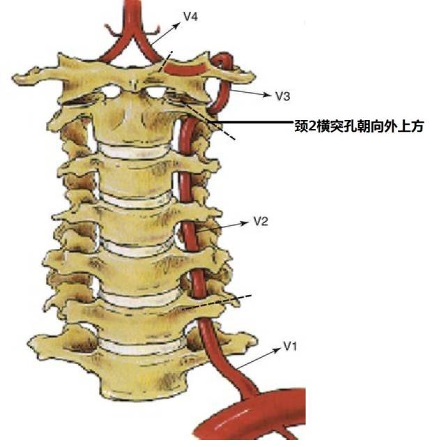 椎动脉分段示意图图片