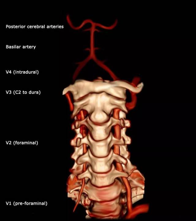 椎动脉v4图片