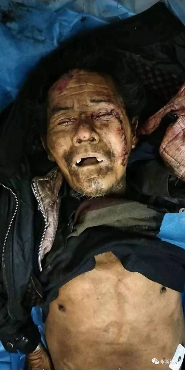 永新:尸源协查通报