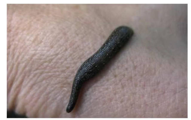 美容院用蚂蝗给女客人治疗青春痘,水蛭在脸上爬行吸血吸毒素!