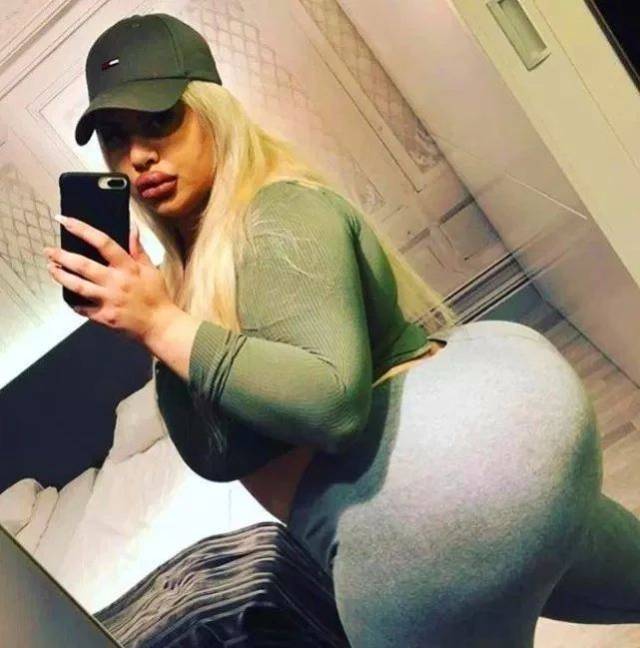 瑞典女子为做丰臀手术增肥20公斤,如今她已整容成瘾!