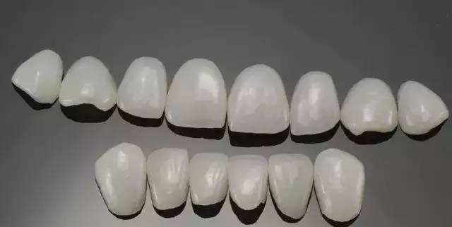 牙齿贴面怎么样牙齿贴面好不好