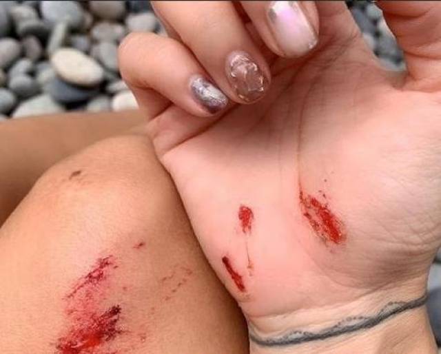 徐濠萦受伤未影响马拉松爱好,跑步偶遇谢贤父子,谢霆锋大方自拍