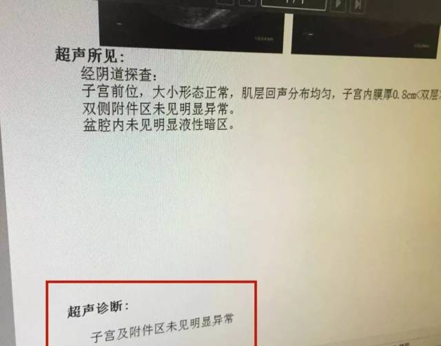 汪劍嬪醫師初步診斷黃女士可能懷孕了,就給她開了b超單,看看胚胎情況