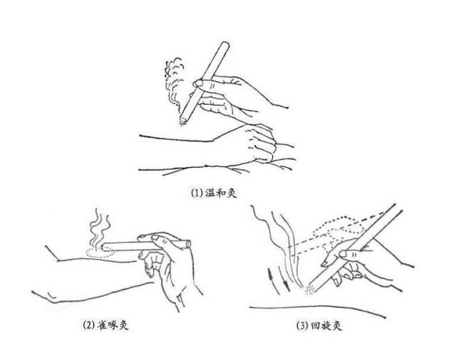 ②雀啄灸 施灸时,艾条点燃的