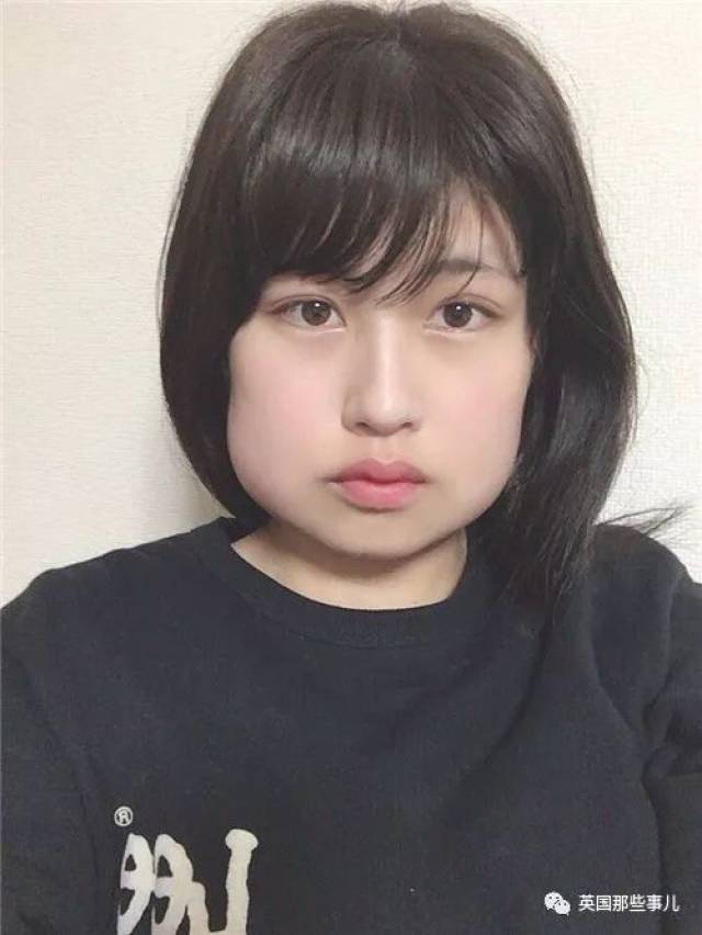 再可爱的妹子,拔完智齿也是一秒肿成歪脸姆明啊!