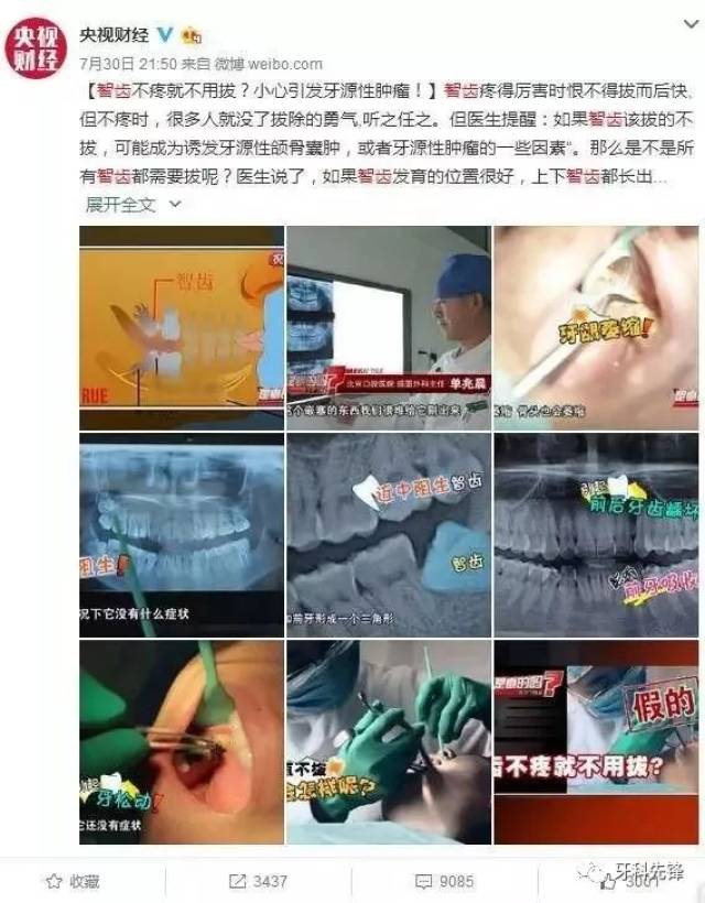 央視:智齒不疼就不用拔?小心引發牙源性腫瘤