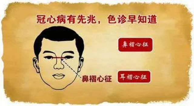 也就是两眼的中间,会有一根横纹,还有的会出现一条青筋,称为鼻褶心征