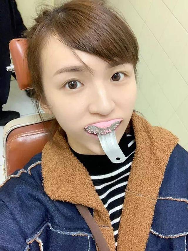 tvb小花为拍新戏扮丑角 龅牙造型获网民激赞:太可爱了!_手机搜狐网