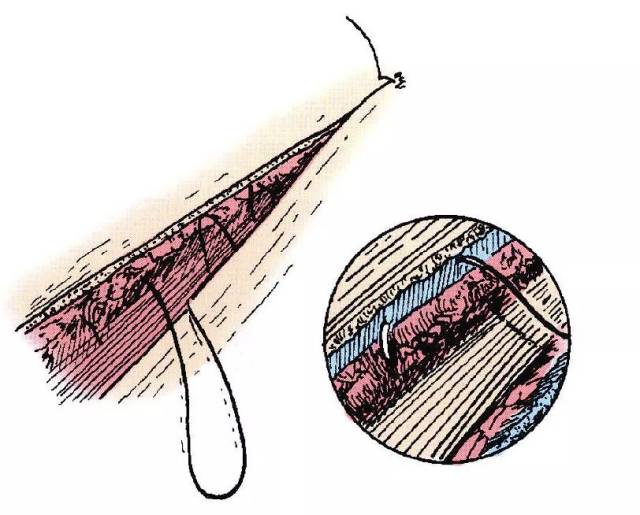 宠医常用的 13种外科缝合方法
